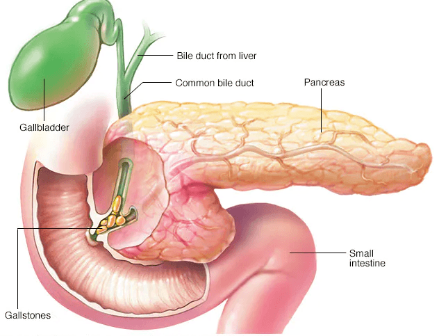 pancreatitis_medigest_gastro_liver_and_endoscopy_clinic