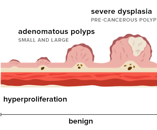 benign-medigest-gastro-liver-and-endoscopy-clinic
