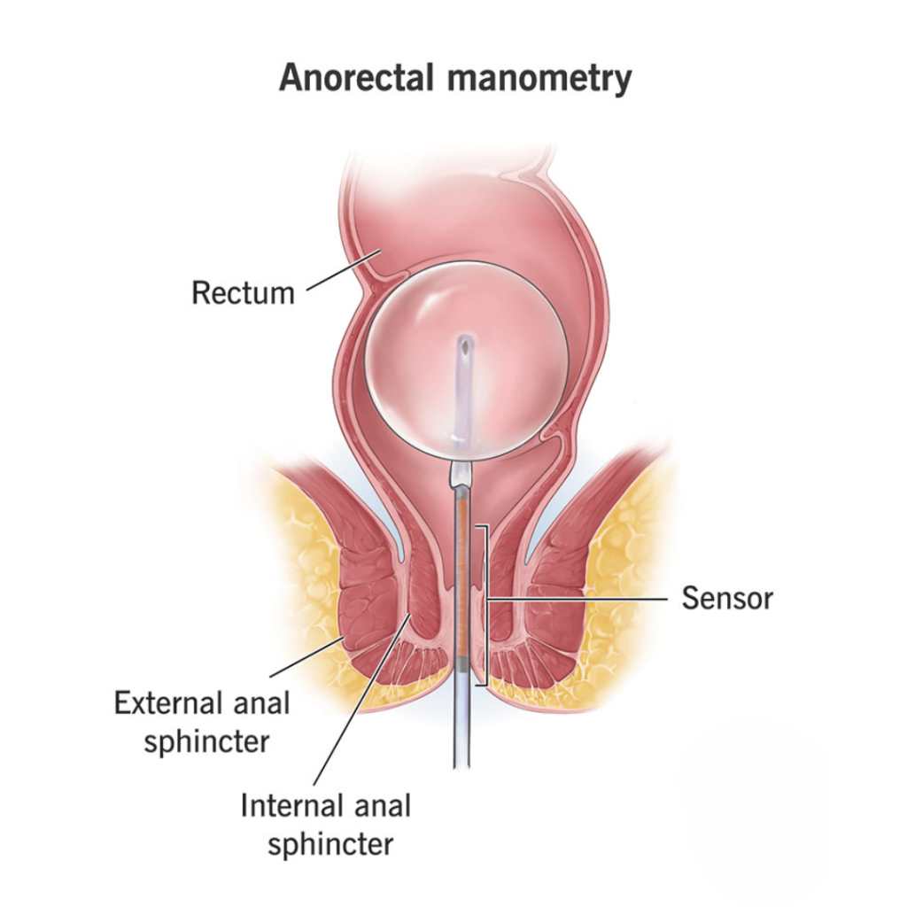 Anorectal Manometry