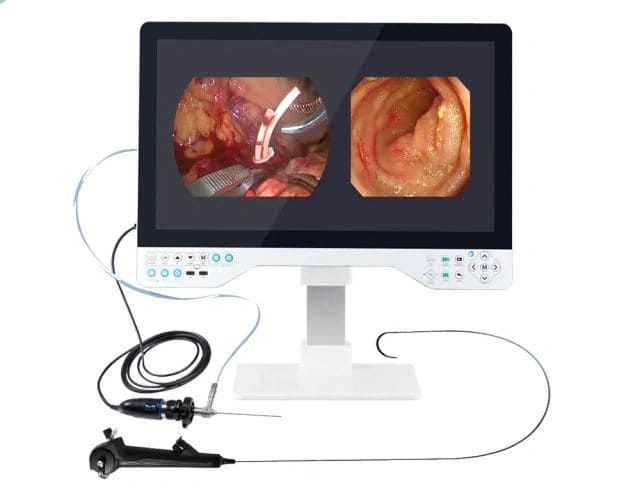 Modern endoscopy technology system showing internal organ images on a medical monitor.
