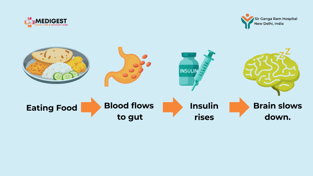 Medical infographic explaining why you feel sleepy after eating food intake, blood flow to gut, insulin rise, and brain slowdown.
