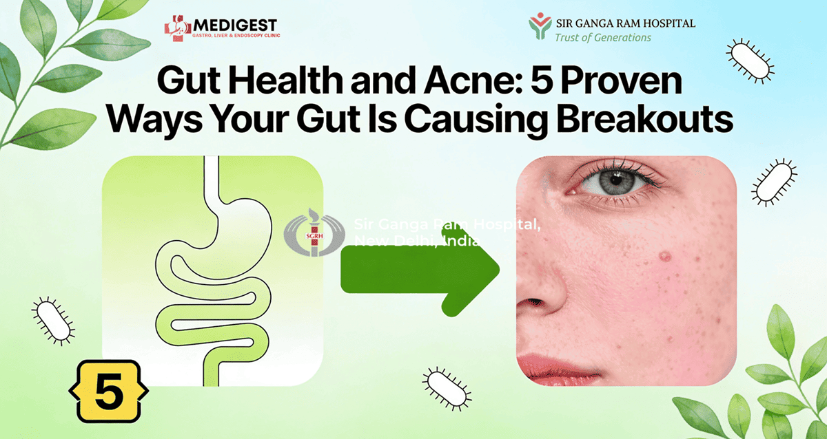 Gut Health and Acne: 5 Proven Ways Your Gut Is Causing Breakouts